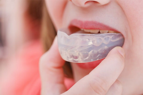 Prevent Dental Wear & Tear With a Custom Mouthguard